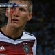 Illustration for article titled Schweinsteiger: Bloodied